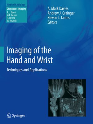 cover image of Imaging of the Hand and Wrist